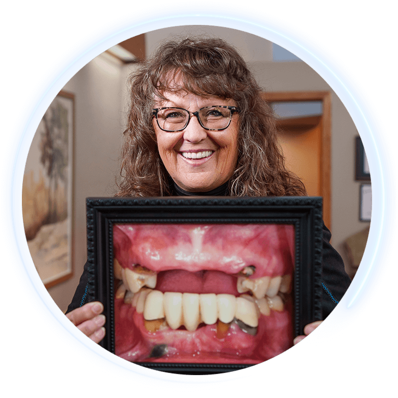before and after dental implant patient
