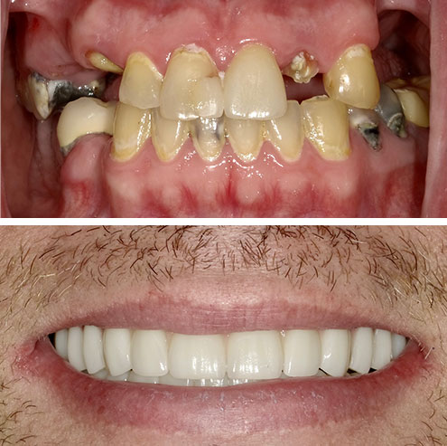 rob before after
