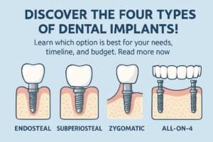A diverse group of patients are smiling, each showcasing a different type of dental implant; endosteal, subperiosteal, zygomatic, and All-on-4. No text on the image.